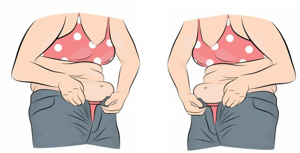 graisse-abdominale-pourquoi-il-est-urgent-de-s-en-occuper